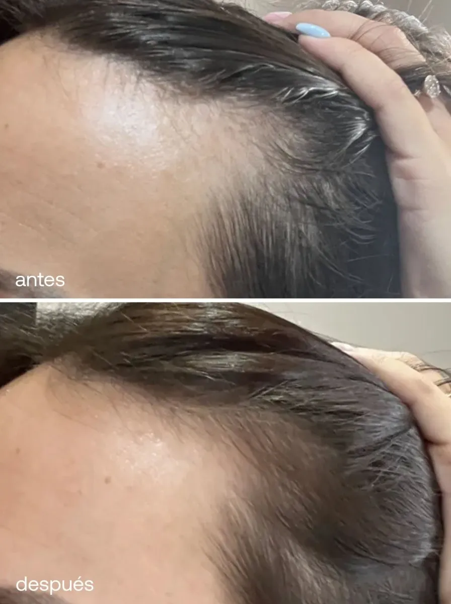 Mini Esenciales para el Cuidado del Cabello
